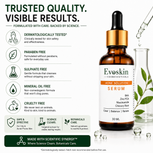 Acne Solution Face Serum 30 ml
