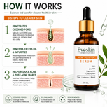 Acne Solution Face Serum 30 ml