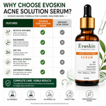 Acne Solution Face Serum 30 ml