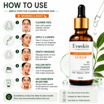 Acne Solution Face Serum 30 ml